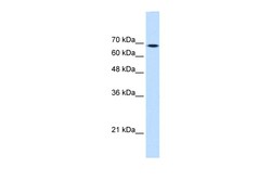 Aviva Systems Biology Corp TGM2 Antibody - middle region (ARP47471_P050)