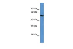 Aviva Systems Biology Corp Fto Antibody - N-terminal region (ARP47473_P050)