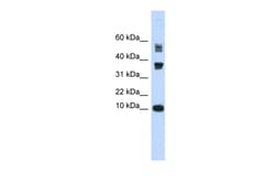 Aviva Systems Biology Corp FABP3 Antibody - middle region (ARP47482_P050)