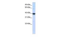 Aviva Systems Biology Corp ETV3L Antibody - C-terminal region (ARP47497_P050)