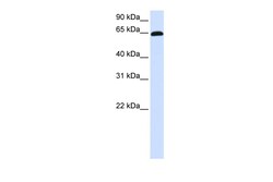 Aviva Systems Biology Corp ZNF37A Antibody - C-terminal region (ARP47501_P050)