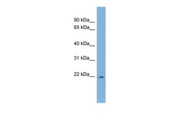 Aviva Systems Biology Corp LBX2 Antibody - middle region (ARP47508_P050)