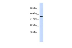 Aviva Systems Biology Corp EMX1 Antibody - middle region (ARP47535_P050)