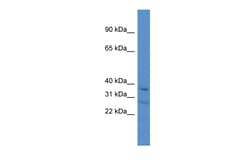 Aviva Systems Biology Corp Tcea3 Antibody - C-terminal region (ARP47565_P050)