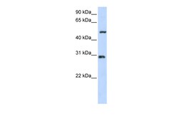 Aviva Systems Biology Corp ZNF138 Antibody - N-terminal region (ARP47605_P050)