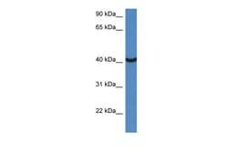 Aviva Systems Biology Corp Morf4l1 Antibody - middle region (ARP47607_P050)
