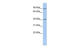 Aviva Systems Biology Corp MEIS3 Antibody - middle region (ARP47649_P050)