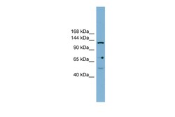 Aviva Systems Biology Corp VARS2 Antibody - middle region (ARP47652_P050)