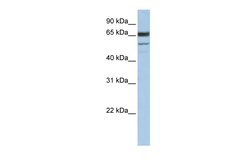 Aviva Systems Biology Corp SELENON Antibody - C-terminal region (ARP47655_P050)