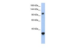 Aviva Systems Biology Corp XPO5 Antibody - middle region (ARP47663_P050)