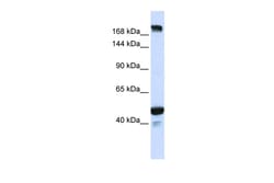 Aviva Systems Biology Corp KIAA1618 Antibody - N-terminal region (ARP47668_P050)
