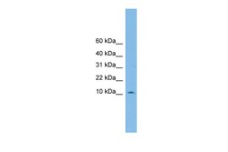 Aviva Systems Biology Corp PHF5A Antibody - middle region (ARP47695_P050)