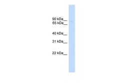 Aviva Systems Biology Corp ZNF483 Antibody - middle region (ARP47710_P050)