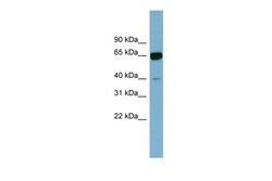 Aviva Systems Biology Corp ZNF169 Antibody - N-terminal region (ARP47749_P050)