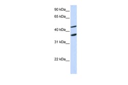 Aviva Systems Biology Corp GAS7 Antibody - N-terminal region (ARP47758_P050)