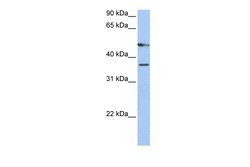 Aviva Systems Biology Corp FOXD4 Antibody - C-terminal region (ARP47767_P050)