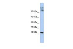 Aviva Systems Biology Corp CKLF Antibody - N-terminal region (ARP47947_P050)