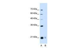 Aviva Systems Biology Corp OOSP2 Antibody - middle region (ARP47958_P050)