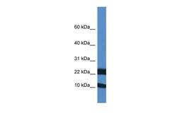 Aviva Systems Biology Corp Fxn Antibody - middle region (ARP47971_P050)