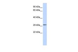 Aviva Systems Biology Corp SPATA46 Antibody - middle region (ARP48010_P050)