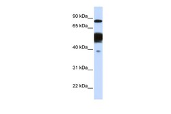 Aviva Systems Biology Corp NEXN Antibody - middle region (ARP48028_P050)
