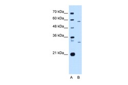 Aviva Systems Biology Corp CD36 Antibody - N-terminal region (ARP48129_P050)