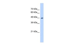 Aviva Systems Biology Corp HADHB Antibody - C-terminal region (ARP48133_P050)