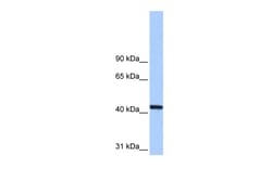 Aviva Systems Biology Corp PGK1 Antibody - N-terminal region (ARP48140_P050)