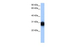 Aviva Systems Biology Corp TPI1 Antibody - N-terminal region (ARP48144_P050)