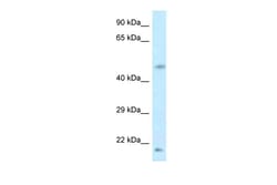 Aviva Systems Biology Corp LOC100360413 Antibody - middle region (ARP48165_P050)