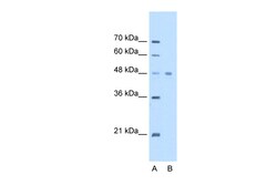Aviva Systems Biology Corp EEF1A1 Antibody - C-terminal region (ARP48166_T100)