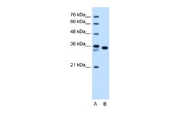 Aviva Systems Biology Corp AKR1B1 Antibody - C-terminal region (ARP48180_T100)
