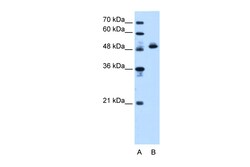 Aviva Systems Biology Corp ATP5F1B Antibody - N-terminal region (ARP48185_T100)