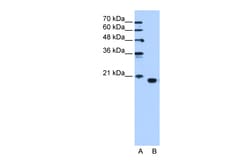 Aviva Systems Biology Corp PEBP1 Antibody - C-terminal region (ARP48212_T100)
