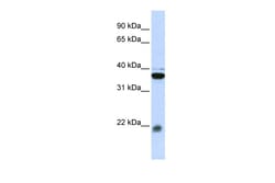 Aviva Systems Biology Corp MYL9 Antibody - middle region (ARP48288_P050)