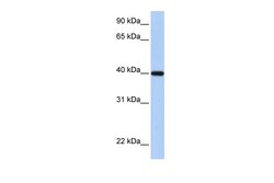Aviva Systems Biology Corp RDH11 Antibody - C-terminal region (ARP48350_P050)