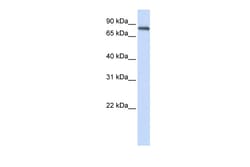 Aviva Systems Biology Corp ACP6 Antibody - N-terminal region (ARP48363_P050)