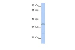 Aviva Systems Biology Corp OCIAD1 Antibody - C-terminal region (ARP48378_P050)