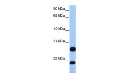 Aviva Systems Biology Corp RSRP1 Antibody - C-terminal region (ARP48388_P050)