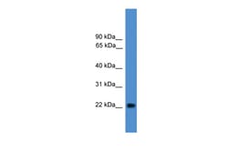 Aviva Systems Biology Corp NUDT16L1 Antibody - middle region (ARP48417_P050)