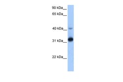 Aviva Systems Biology Corp GPSN2 Antibody - middle region (ARP48431_P050)