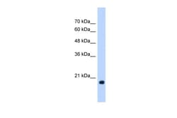 Aviva Systems Biology Corp HSPB6 Antibody - middle region (ARP48436_T100)