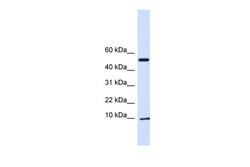 Aviva Systems Biology Corp ATP5IF1 Antibody - N-terminal region (ARP48451_P050)