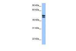 Aviva Systems Biology Corp OXCT1 Antibody - middle region (ARP48481_P050)