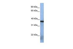 Aviva Systems Biology Corp NAT12 Antibody - middle region (ARP48508_P050)
