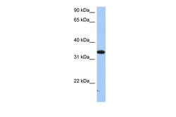 Aviva Systems Biology Corp SULT6B1 Antibody - C-terminal region (ARP48531_P050)