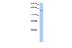 Aviva Systems Biology Corp MBOAT1 Antibody - N-terminal region (ARP48548_P050)