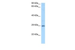 Aviva Systems Biology Corp GSTA4 Antibody - N-terminal region (ARP48554_P050)