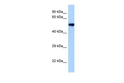 Aviva Systems Biology Corp Oxsr1 Antibody - middle region (ARP48661_P050)