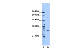 Aviva Systems Biology Corp METTL1 Antibody - middle region (ARP48665_T100)